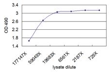 Anti-CNN1 Mouse Monoclonal Antibody (Biotin)