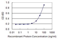 Anti-DCAF8 Mouse Monoclonal Antibody [clone: 4G8]