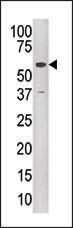 Anti-HIV-1 Tat Interacting Protein, 60kD Rabbit Polyclonal Antibody (PE (Phycoerythrin))