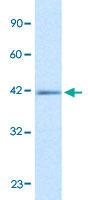 Anti-IKZF2 Rabbit Polyclonal Antibody