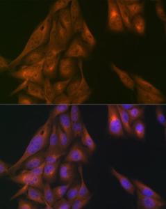 Immunofluorescence analysis of U2OS cells using Anti-USP11 Antibody (A308222) at a dilution of 1:100 (40X lens). DAPI was used to stain the cell nuclei (blue)