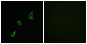 Immunofluorescence analysis of HUVEC cells using Anti-FGF23 Antibody. The right hand panel represents a negative control, where the antibody was pre-incubated with the immunising peptide.