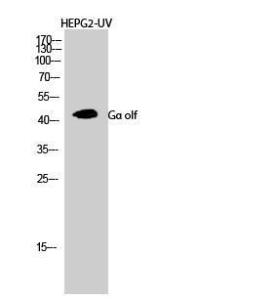 Anti-GNAL antibody