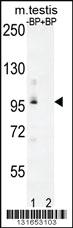 Anti-PDPR Rabbit Polyclonal Antibody