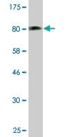 Anti-STK33 Mouse Monoclonal Antibody [clone: 4F7]