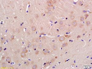 Anti-GLS2 Rabbit Polyclonal Antibody