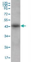 Anti-APOL1 Mouse Monoclonal Antibody [clone: 1D4]