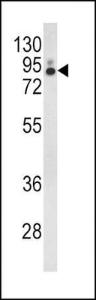 Anti-PLA2G4A Rabbit Polyclonal Antibody (HRP (Horseradish Peroxidase))