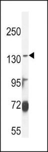 Anti-ABCC3 Rabbit Polyclonal Antibody (PE (Phycoerythrin))