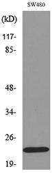 Western blot analysis of lysate from SW480 cells using Anti-FGF20 Antibody