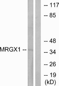 Western blot analysis of lysates from MCF-7 cells using Anti-MRGX1 Antibody. The right hand lane represents a negative control, where the antibody is blocked by the immunising peptide.