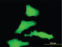 Anti-RAB31 Mouse Monoclonal Antibody [clone: 4D12]