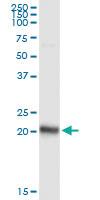 Anti-FNDC4 Rabbit Polyclonal Antibody