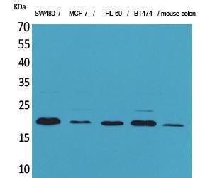 Western blot analysis of SW480, MCF 7, HL 60, BT474, mouse colon cells using Anti-FGF20 Antibody