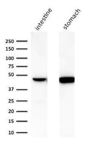 Western blot analysis of (A) human intestine and (B) human stomach lysates using Anti-Cytokeratin 18 Antibody [C-04]