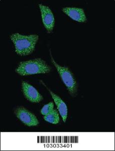 Anti-DAP Kinase 1 (DAPK1) Rabbit Polyclonal Antibody