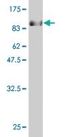 Anti-STK33 Mouse Monoclonal Antibody [clone: 3F10]