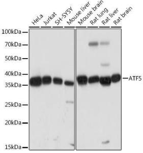 Western blot analysis of extracts of various cell lines, using Anti-ATF5 Antibody [ARC2043] (A308224) at 1:1,000 dilution. The secondary antibody was Goat Anti-Rabbit IgG H&L Antibody (HRP) at 1:10,000 dilution.