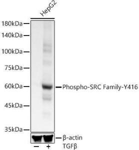 Western blot analysis of HepG2, using Anti-Src (phospho Tyr416) Antibody [ARC57736] (A309701) at 1:300 dilution