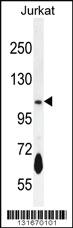 Anti-PDE3B Rabbit Polyclonal Antibody