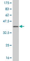 Anti-FIS1 Mouse Monoclonal Antibody [clone: 1G9]