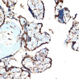 Immunohistochemistry analysis of paraffin-embedded human placenta using Anti-ATF5 Antibody [ARC2043] (A308224) at a dilution of 1:100 (40x lens). Perform microwave antigen retrieval with 10 mM Tris/EDTA buffer pH 9.0 before commencing with IHC staining protocol.