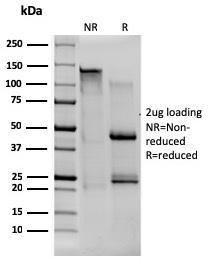 SDS-PAGE analysis of Anti-CD80 Antibody [C80/1608] under non-reduced and reduced conditions; showing intact IgG and intact heavy and light chains, respectively SDS-PAGE analysis confirms the integrity and purity of the antibody