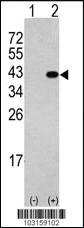 Anti-DAPK2 Rabbit Polyclonal Antibody