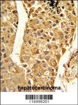 Anti-CYP2C18 Rabbit Polyclonal Antibody