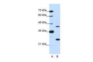 Anti-MINA Rabbit Polyclonal Antibody