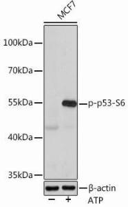 Western blot analysis of extracts of MCF7 cells, using Anti-p53 (phospho Ser6) Antibody (A308225) at 1:1,000 dilution MCF7 cells were treated by ATP(5 mM) at 30°C for 1 hour