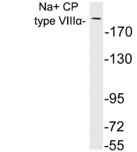 Anti-Naand CP type VIIIalpha antibody