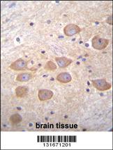 Anti-PCDH1 Rabbit Polyclonal Antibody