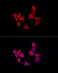 Immunofluorescence analysis of NIH-3T3 using Anti-PDXK.1 Antibody (A307205) at a dilution of 1:100 (40x lens). DAPI was used to stain the cell nuclei (blue)