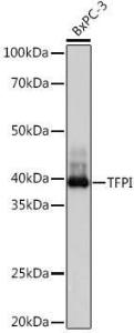 Anti-TFPI Rabbit Monoclonal Antibody [clone: ARC1154]