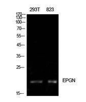 Western blot analysis of extracts from 293T, 823 cells using Anti-EPGN Antibody