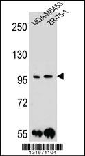 Anti-PCDH1 Rabbit Polyclonal Antibody