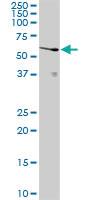 Anti-UCKL1 Rabbit Polyclonal Antibody