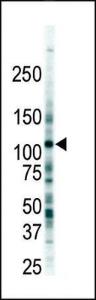 Anti-FLT3 Rabbit Polyclonal Antibody (Biotin)