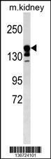 Anti-ABCC9 Rabbit Polyclonal Antibody (AP (Alkaline Phosphatase))