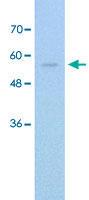 Anti-IRX3 Rabbit Polyclonal Antibody