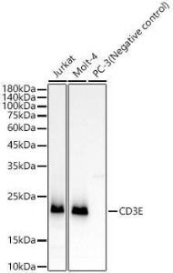 Western blot analysis of extracts of Jurkat cells, using Anti-CD3 epsilon Antibody [ARC51750] (A308227) at 1:1,000 dilution. The secondary antibody was Goat Anti-Rabbit IgG H&L Antibody (HRP) at 1:10,000 dilution.