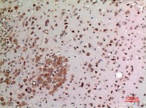 Immunohistochemical analysis of paraffin-embedded rat brain using Anti-FGF20 Antibody