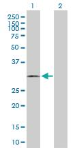 Anti-CNN2 Mouse Polyclonal Antibody