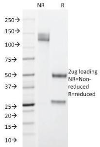 Anti-Cytokeratin 19 antibody