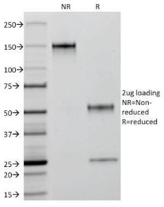 SDS-PAGE analysis of Anti-Cytokeratin 18 Antibody [C-04] under non-reduced and reduced conditions; showing intact IgG and intact heavy and light chains, respectively SDS-PAGE analysis confirms the integrity and purity of the antibody