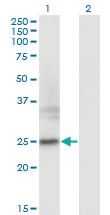 Anti-FNDC4 Mouse Monoclonal Antibody [clone: 7F9]