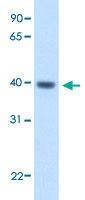 Anti-ITGB1BP2 Rabbit Polyclonal Antibody