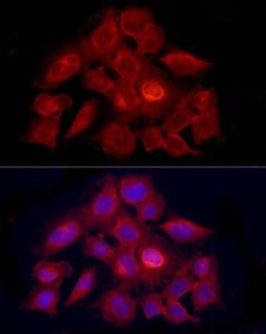 Immunofluorescence analysis of HeLa using Anti-PDXK.1 Antibody (A307205) at a dilution of 1:100 (40x lens). DAPI was used to stain the cell nuclei (blue)