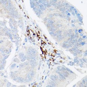 Anti-TNF alpha Rabbit Polyclonal Antibody